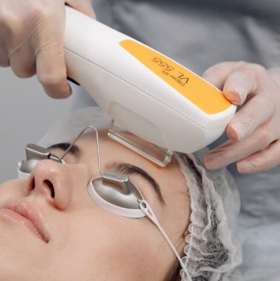 Laser IPL
