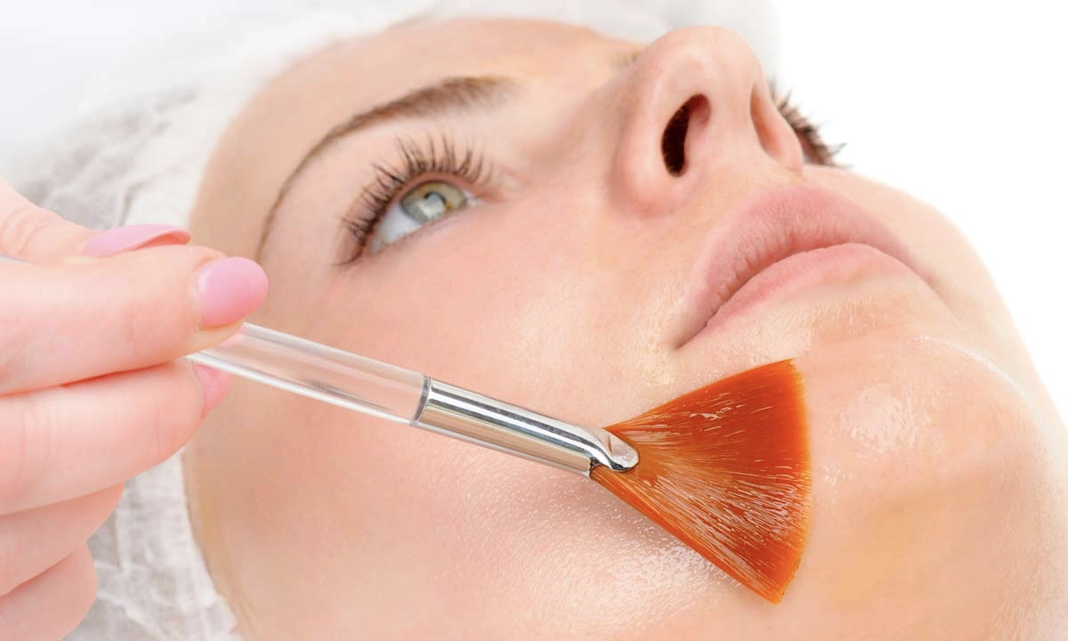 Peeling médical à Paris 11, Paris 12 et Nation – un teint plus lumineux et une peau plus lisse
